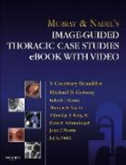 Bild von Murray & Nadel's Image-Guided Thoracic Case Studies - E-Book with Video (eBook)