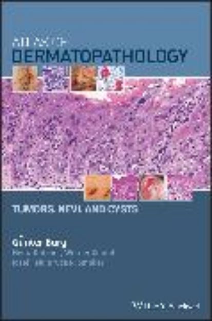 Bild von Atlas of Dermatopathology Tumors and Cysts von Günter Burg