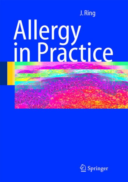 Bild von Allergy in Practice von Johannes Ring